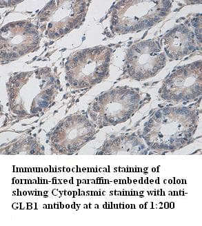 Polyclonal Rabbit anti-Human GLB1 / Beta-Galactosidase Antibody (C-Terminus, IHC)