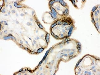 ANXA3 / Annexin A3 Antibody