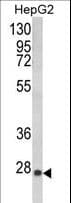 GSTA1 Antibody