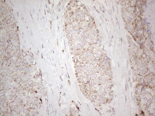 Monoclonal Mouse anti-Human ANGPTL8 / Betatrophin Antibody (clone OTI1B12, Carrier-free, aa22-198, IHC, WB)