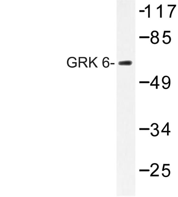 Polyclonal Rabbit anti-Human GRK6 Antibody (Asn22, IF, WB)