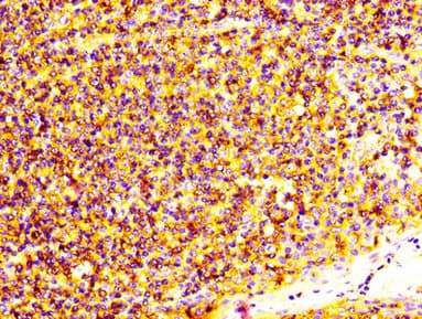 S100A4 / FSP1 Antibody