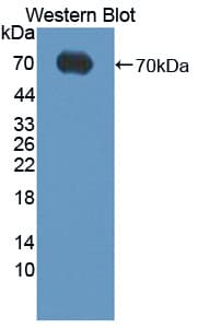 ADK / Adenosine Kinase Antibody (aa1-361)