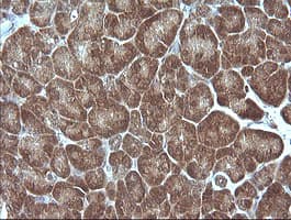 MAP2K1 / MKK1 / MEK1 Antibody (clone OTI3H3)