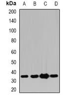 PDXK / PNK Antibody