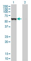 GBA / Glucosidase Beta Acid Antibody (clone 2e2)