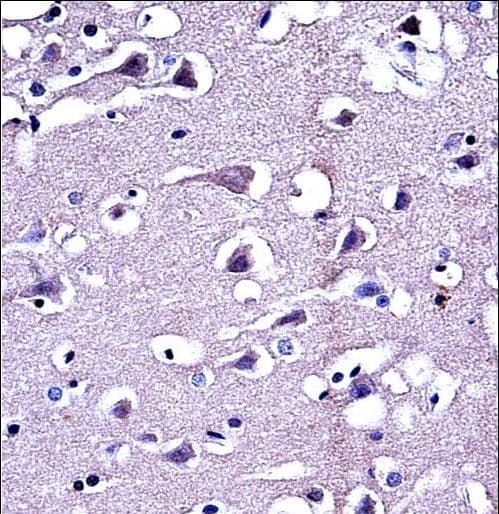 Polyclonal Rabbit anti-Human MMP16 Antibody (aa519-548, IHC, WB)