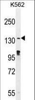 OVOS2 Antibody (aa99-128)
