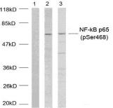 RELA / NFKB p65 Antibody