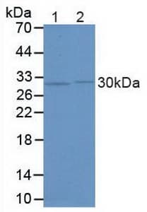 FKBP5 / FKBP51 Antibody (aa2-457)