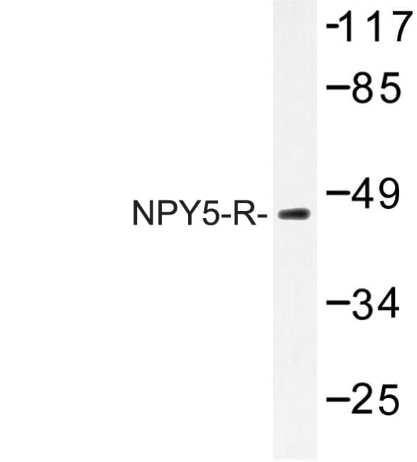 Polyclonal Rabbit anti-Human NPY5R Antibody (Met264, IHC, IF, WB)