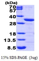 Human CLIC1 / NCC27 Protein (Recombinant His)