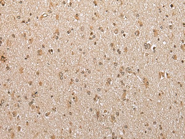 Polyclonal Rabbit anti-Human ABHD14B Antibody (IHC, WB)