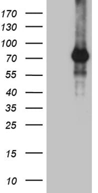 Monoclonal Mouse anti-Human ZNF264 Antibody (clone OTI8G5, WB)