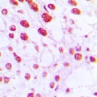 Polyclonal Rabbit anti-Human POLB / DNA Polymerase Beta Antibody (C-Terminus, IHC, WB)
