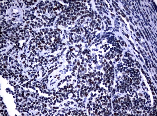 NBN / Nibrin Antibody (aa183-460, clone UMAB100, Carrier-free)