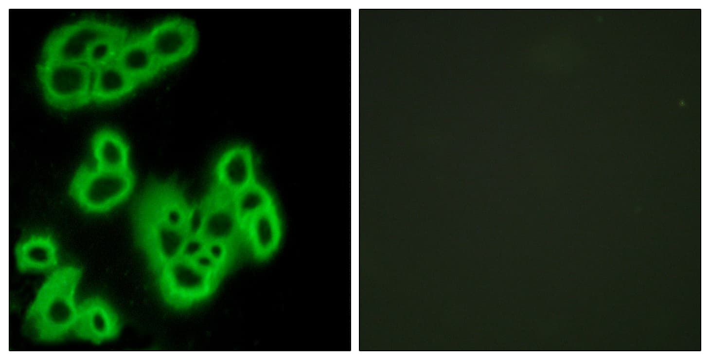 IHC-plus™ FPR1 / FPR Antibody (aa155-204)