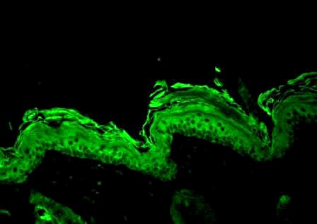 Polyclonal Rabbit HSP90 Beta Antibody (IHC, IF, WB)