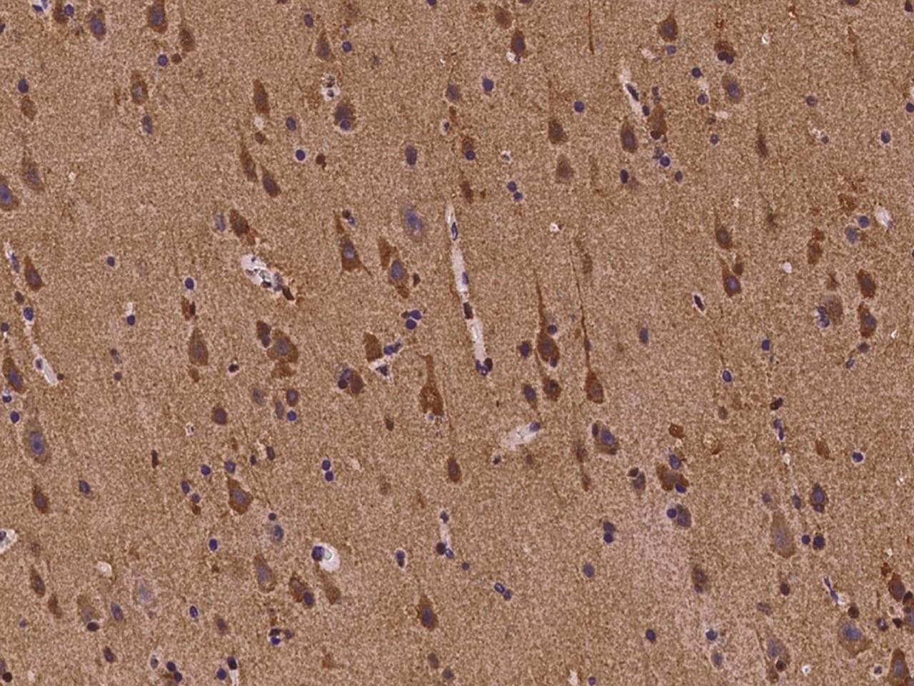 ABI2B / ABI2 Antibody
