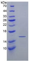 Mouse IFN Gamma / Interferon Gamma Protein (Recombinant His)