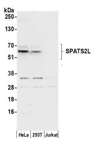 SPATS2L Antibody (aa508-558)
