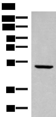PSMD12 / Rpn5 Antibody