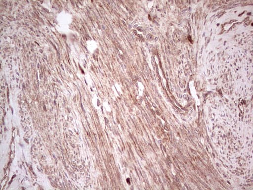 UBE2D2 / UBCH5B Antibody (clone OTI2C2)