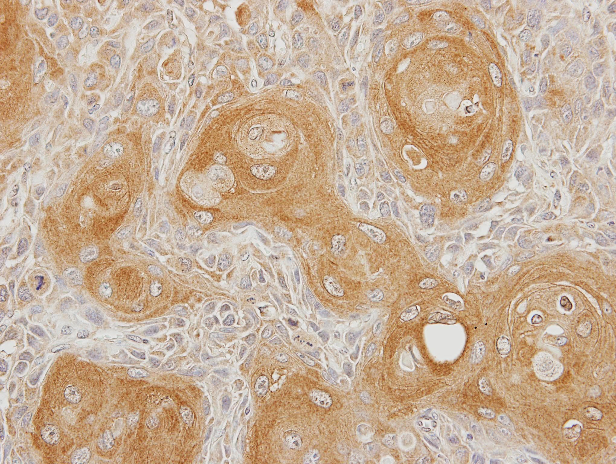INPP5B Antibody (aa699-949)