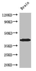 PDEF / SPDEF Antibody (aa145-247)
