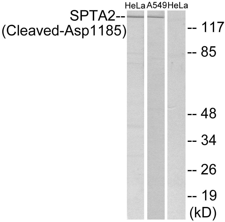 SPTAN1 / Alpha Fodrin Antibody (Cleaved-Asp1185)