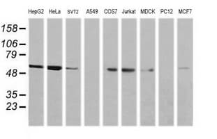 NONO / P54NRB Antibody (clone OTI3F8)