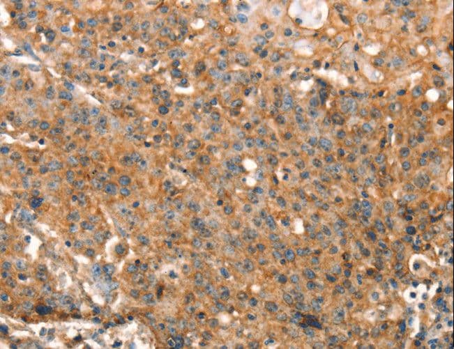 DRAK1 / STK17A Antibody
