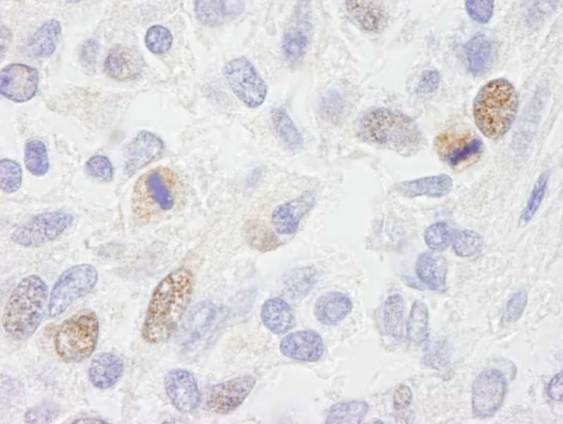 CENPF / CENP-F Antibody (aa2350-2400)