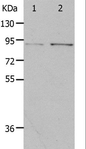 PIBF1 / PIBF Antibody