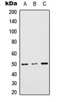 Polyclonal Rabbit anti-Human TTC23 Antibody (C-Terminus, WB)