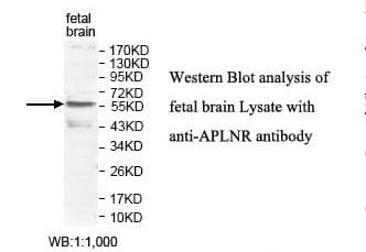 IHC-plus™ Polyclonal Rabbit anti-Human APLNR/ Apelin Receptor / APJ Antibody (aa310-380, IHC, WB)