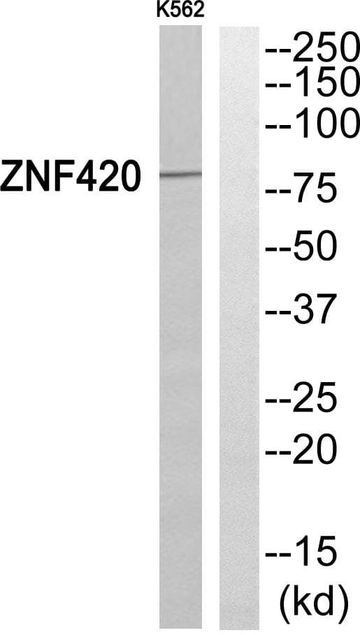 Polyclonal Rabbit anti-Human ZNF420 Antibody (WB)