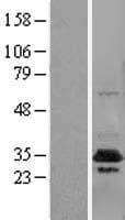CUEDC2 Protein (Over-Expression Lysate Myc-DDK (Flag))