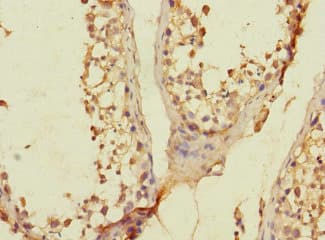 Polyclonal Rabbit anti-Human SLC36A3 Antibody