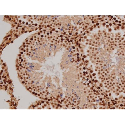 FAK / Focal Adhesion Kinase Antibody (phospho-Tyr397)