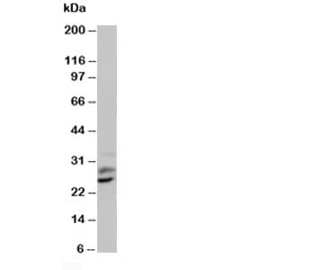 PGF / PLGF Antibody (aa206-221)