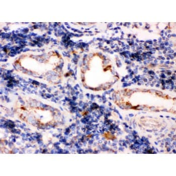 TPP1 / CLN2 Antibody (aa227-261)