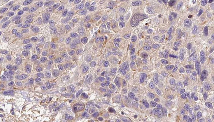 CFHR3 / CFHL3 Antibody