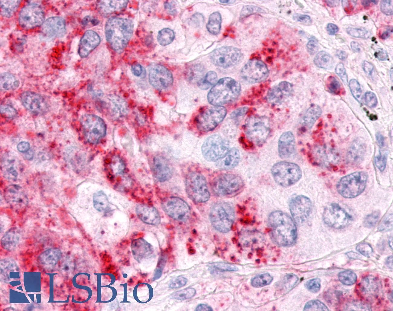 IHC-plus™ ESRRA / ERR Alpha Antibody (Ligand-binding Domain)