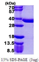 Human PPCS Protein (Recombinant His)