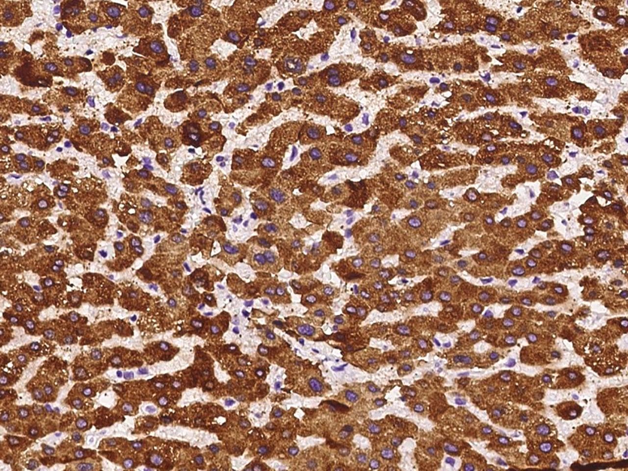 HSD17B6 Antibody