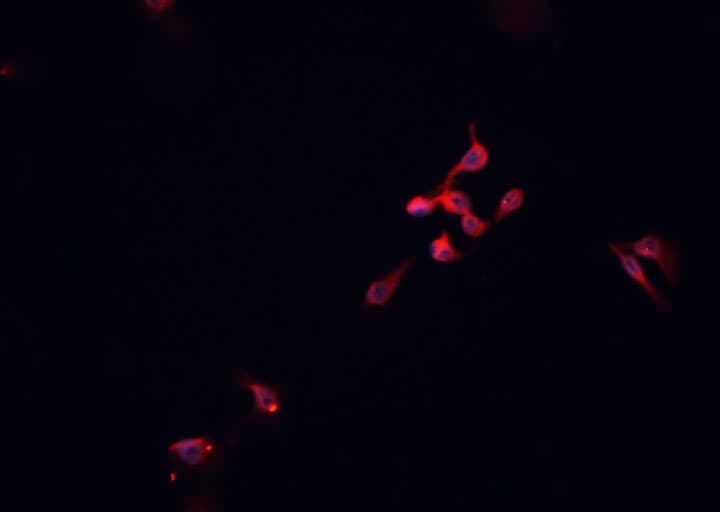 Polyclonal Rabbit anti-Human MED1 / TRAP220 Antibody (IF, WB)
