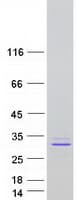 Human PRL / Prolactin Protein (Recombinant Myc-DDK (Flag))