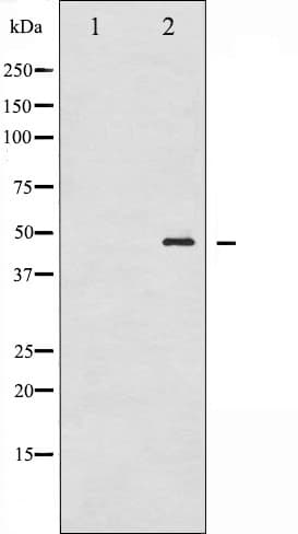 GATA1 Antibody (phospho-Ser142)