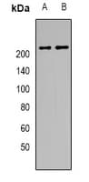 Polyclonal Rabbit anti-Human TNRC6A / GW182 Antibody (WB)
